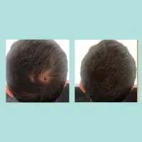 معجزه ی ر.ش و م.هات اینجاست