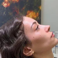 ۵۰ درصد تخفیف عمل جراحی بینی بدون تامپون با پیزو