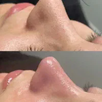 پاکسازی تخصصی پوست آفر محدود فقط ۵۸۰ هزار تومان