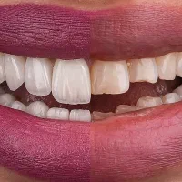 لمینت تخصصی باماندگاری بالا