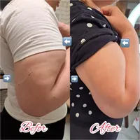 لاغری شکم و پهلو ، ران و بازو ، لیفت با کاشت نخ|خدمات آرایشگری و زیبایی|تهران, نارمک|دیوار