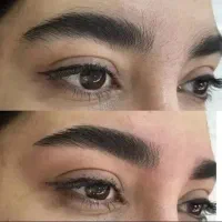 اطلاح صورت وابروکاملارایگان