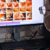 خدمات آندوسکوپی و کلونوسکوپی و بوتاکس معده