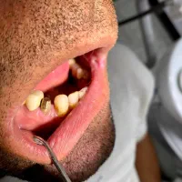 دندانپزشکی ارزان و اقساطی
