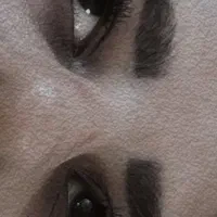 کاشت مژه موقت
