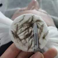 اصلاح درماپلنینگ