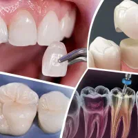 دندانپزشکی زیبایی ترمیمی