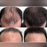 گیاهی و بدون عوارض