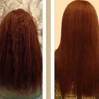 مدل پروبوتاکس مو تضمینی