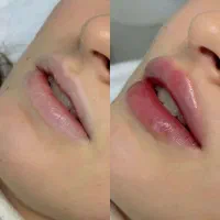 مرکز تخصصی ژل لب منطقه