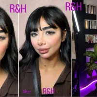 فیلربادی اقساط هیپدیپ باسن/کاشت ابروموژل/کانتورینگ