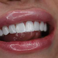 دستیار دندانپزشکی زیبایی