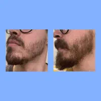 از ریش شلخته تا ریش فول آپشن