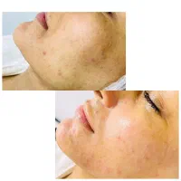 پوست شما سرمایه شماست