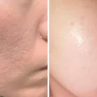 صابون سفید کننده تضمینی سوسنگرد