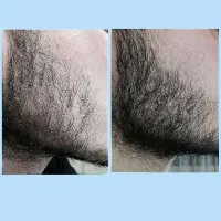 مرد شو|آرایشی، بهداشتی، درمانی|تویسرکان, |دیوار