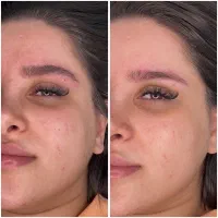 مدل برای میکروبلیدینگ ابرو