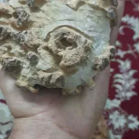 سنگ‌زیبا‌کلکسیونی‌