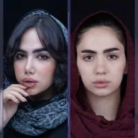 عمل بینی با اقساط در شیراز