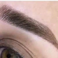 میکروبلیدینگ، فیبروز ابرو