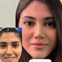 جراحی های زیبایی با بهترین کیفیت و نازلترین قیمت