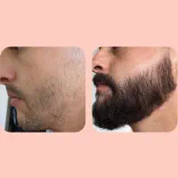 محلول معجزه