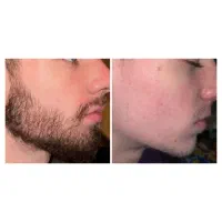 راز داشتن زاهری زیبا فقط با یک قطره