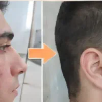 پوست شفاف و روش.ن تر با بیوممتیکک