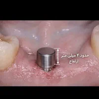 بیمار یاب دندان پزشکی