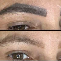تتوی قدیمی داری ریموو تخصصی‌تتوابرو‌وبدن