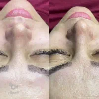 هم برای کراتین و پروتئین و پاک سازی صورت