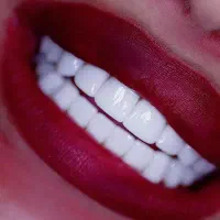 خدمات زیبایی (ونیر کامپوزیت و لمینت )شرایط اقساطی