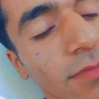 خال ولک وجوش زیر پوستی بدون درد