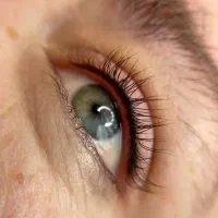 شیدینگ ،فیبروز، خط‌چشم دائم، بن مژه