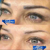 ریمو خط چشم و ابرو