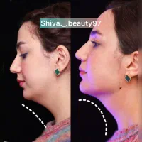 تخفیفات تابستانه کلینیک زیبایی دکتر سعیدی