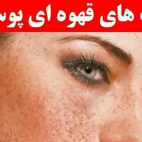 لک قهویی|آرایشی، بهداشتی، درمانی|هشتگرد, مدرس|دیوار