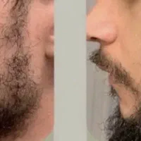 کوسه نباش و پادشاهی کن