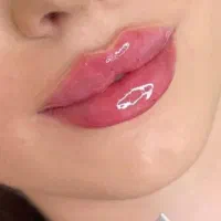 ژل  بوتاکس  مزونیدلینگ