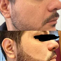 دخترکش شو‌ با ریش پرتر