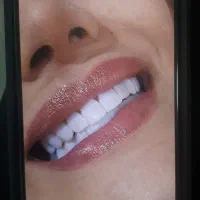 جشنواره کامپوزیت