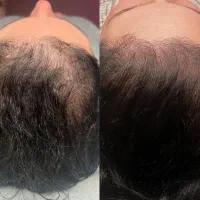 دیگه نمیخواد با تیغ بزنی که نریزه