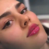 تزریق ژل لب‌فیلر نخ مزوژل بیکینی مادلینگ و زاویه