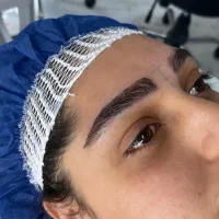 کاشت ابرو فوق تخصصی