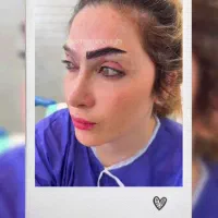 کاشت تخصصی ابرو به روش سوپرمیکروگرفت
