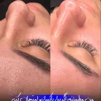 پاکسازی و فیشال تخصصی پوست در کلینیک