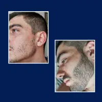 میخوای درش بیاری