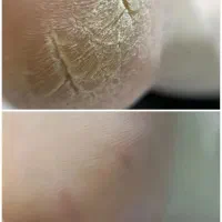 کفسابی پا ب روش خشک روسی