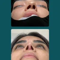 آف محدودجشنواره بینی دراهواز۲۵ت تااخرهفته
