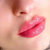 خدمات بوتاکس وژل صورت